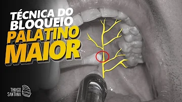O que é forame Nasopalatino?