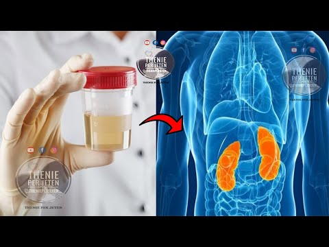 Video: A është formuar urina?