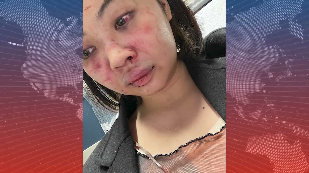 纽约市: 地铁另一亚裔遇袭事故 两个月前模特被打