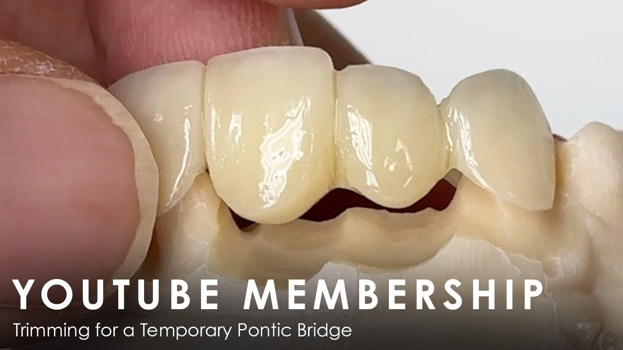 Trimming for a Temporary Pontic Bridge - YouTube