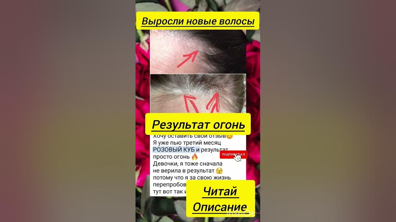 РОЗОВЫЙ КУБ - ВИТАМИНЫ ДЛЯ РОСТА ВОЛОС, НОГТЕЙ #волосы #ногти #рост ...