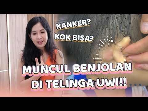 Video: Mengapa kanak-kanak itu mempunyai benjolan di belakang telinga