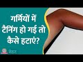 Summer में Skin Tanning क्यों होती है और उसे कैसे ठीक करें, जानिए डॉ. से | Sehat ep 867