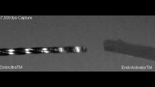 EndoUltra™ vs EndoActivator™ High Speed Camera Footage