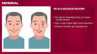 yuz felci nedir prof dr k serkan orhan kulak burun bogaz hastaliklari uzmani youtube