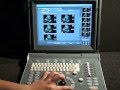 CHISON ECO1 Ultrasound | Operation: How to use, scan, save report, print, and DICOM