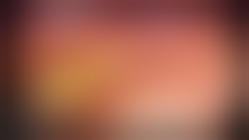 Laparoscopic right inguinal hernia TAPP repair with 3D mesh