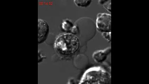 Meet the Unsung Immune Cell that Could Change Immunotherapy (Natural Killer Cells)