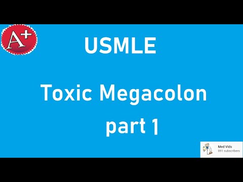 Toxic Megacolon Usmle - A Review