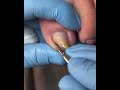 Gentle Toe Grooming | Fresh and Healthy Nail Look  #toenailcare #pedicure #pedicureroutine #fypシ