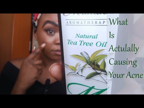 WHAT IS ACTUALLY CAUSING YOUR ACNE || You need Tea Tree oil in your life.