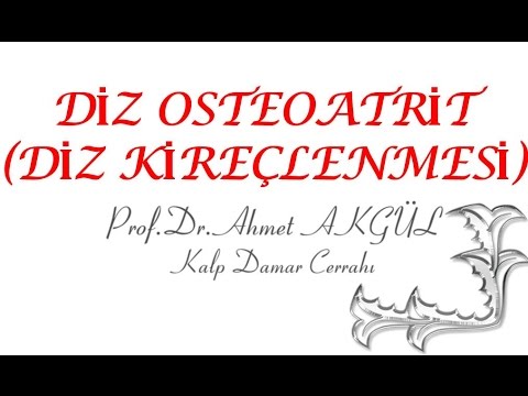 Diz Kireçlenmesinde Kök Hücre Tedavisi - Prof. Dr. Ahmet AKGÜL - AhmetakgulTV