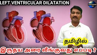 Left Ventricular Dilatation tamil | dilated cardiomyopathy | volume overload in heart | ps tamil