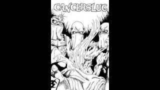 Watch Cancerslug Dopesick Angel video