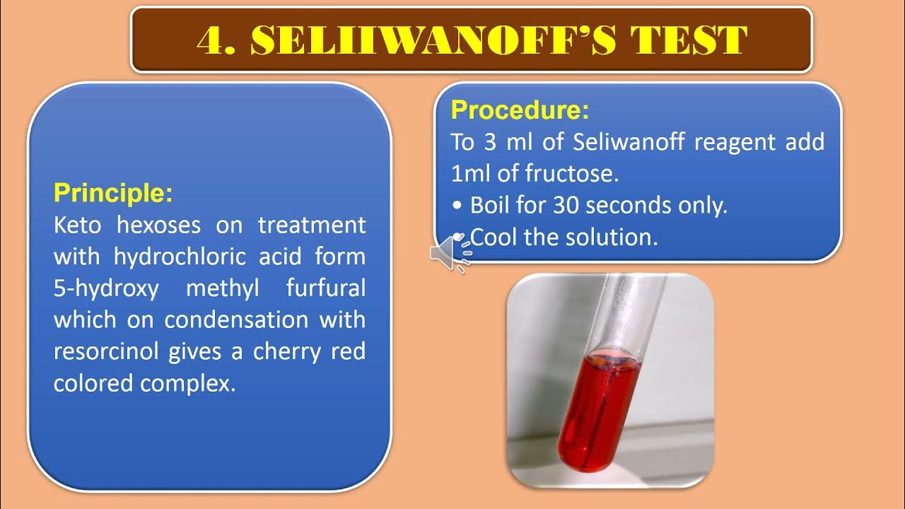 Seliwanoff's test YouTube