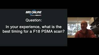 Current Radiopharmaceutical Theranostic Applications in Nuclear Medicine with Dr. Steven Rowe Q&A @MedalityHQ