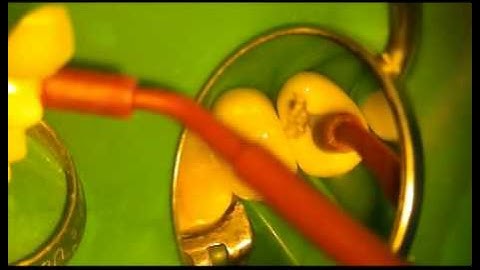 throughthecrown2.avi