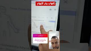 إلتهاب وتر الابهام اليد وتر علاج الم وجع علاج_طبيعي