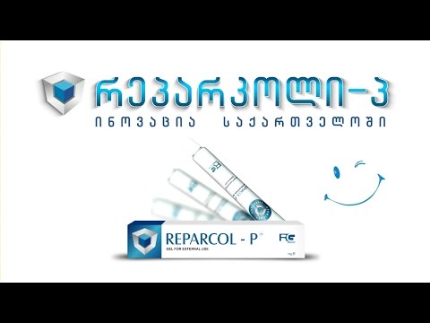იცით თუ არა რა არის რეპარკოლი - პ ?