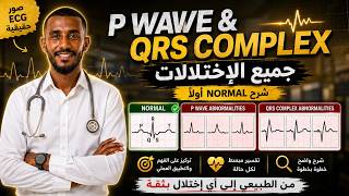 ECG INTERPRETATION2:P WAVE & QRS NORMAL CHARACTERISTICS THEN ABNORMALITIES | شرح رسم القلب من الصفر2