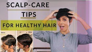 How Scalp Care Can Save Your Hair/ Thin to Thick Hair in 2 Months/ 2020 screenshot 4