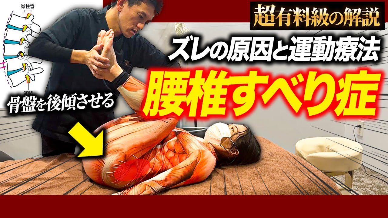【全治療家必見】なぜ、すべり症が起きるのかの解剖学と運動療法について徹底解説！！