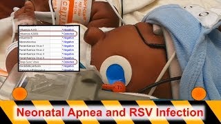 Neonatal Apnea and RSV Infection