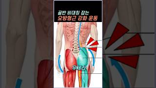 골반 비대칭 잡는 요방형근 강화 운동