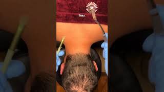 Satisfying Scalp ASMR ✨ Deep Hair Parting & Relaxing Sounds 😴