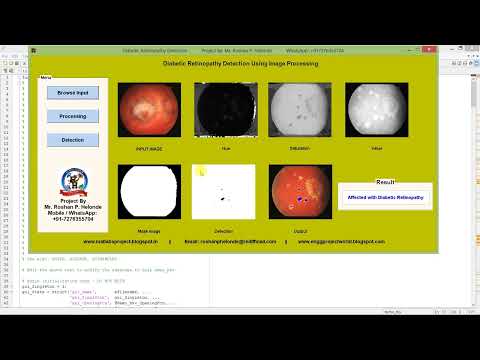 Diabetic Retinopathy Identification Using Matlab Code | Image Processing Project With Source Code