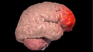 What Is A Frontal Lobe Injury?