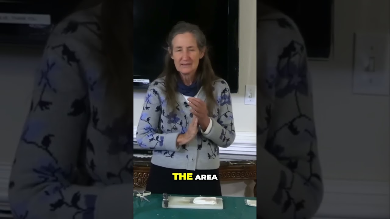 Help! Inflamed Finger  Try This Quick Relief Method! 