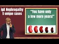 IgA patient always get this warning from their nephrologist, but it is not true | Episode 274