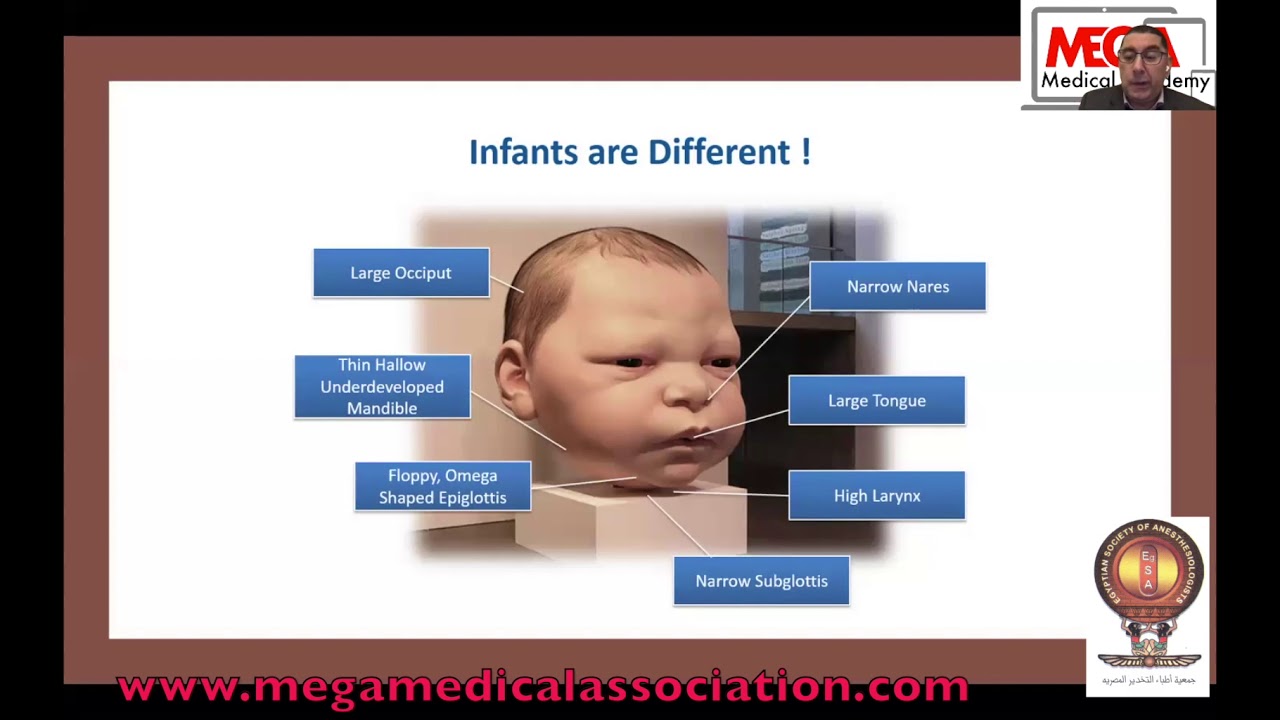 Paediatric Anaesthesia  Why is different? By Dr  Saad Mahdy