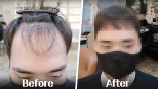 숱 없는 머리에 현실적으로 추천하는 헤어스타일 Best Hairstyle for Thin Hair