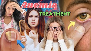 Anemia Treatment | Anemia Causes, Symptoms | Blood Deficiency | How To Treat Anemia anemia