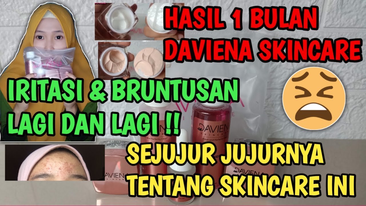 HASIL 1 BULAN PEMAKAIAN DAVIENA SKINCARE JELAS & LENGKAP | REVIEW JUJUR