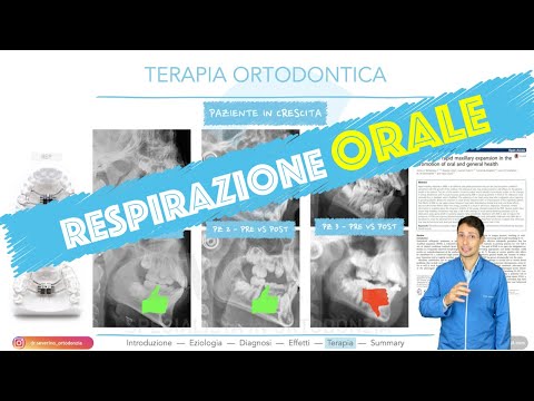 Respirazione orale (cause e terapia dei pazienti che respirano sempre a bocca aperta) - Lezione