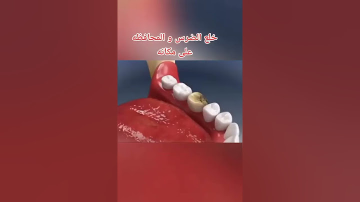 خلع الضرس و المحافظة علي مكانه 💉😷