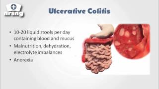 IBD (Inflammatory Bowel Disease) Nursing NCLEX® Review | NRSNGacademy.com