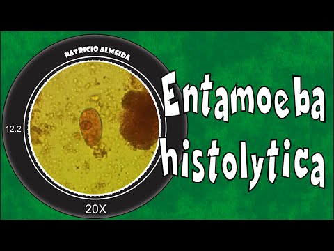 Entamoeba histolytica/dispar
