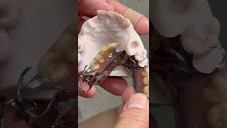 Chrome Cobalt cast partial for Dr. Jason Grebner in South Dakota