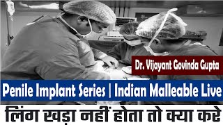 लिंग खड़ा नहीं होता क्या करे | इंडियन पेनिस इम्प्लांट | Penile Implant Surgery Video Hindi