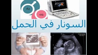 أهمية السونار للسيدات الحوامل وكيفية تحديد نوع الجنين وأنواع السونار المختلفة وهل السونار يضر الحمل؟