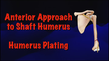 Anterior Approach to Shaft Humerus: Humerus Plating Surgical Techniques