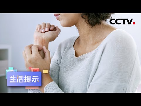 冬季皮肤瘙痒 小心是湿疹 20211217 |《生活提示》CCTV科教