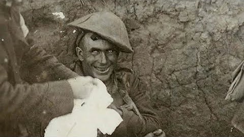 This Is What Shell Shock Looks Like… ☠️