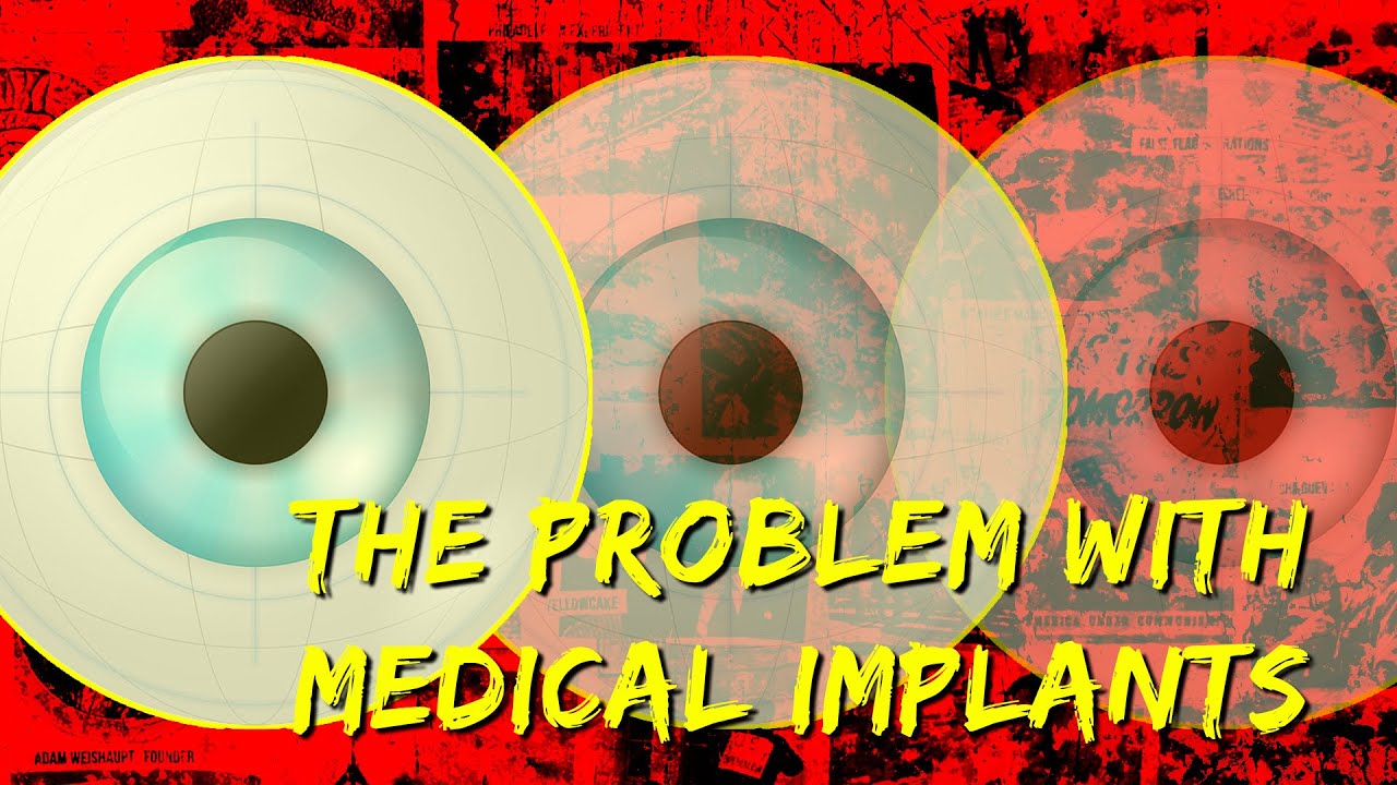 The Problem with Medical Implants YouTube