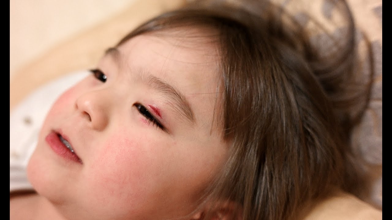 Nosso filho sofreu um acidente... Noite do sushi comendo e desabafando!