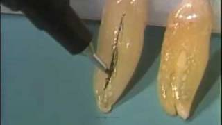 Dental Anatomy: The Canine Teeth